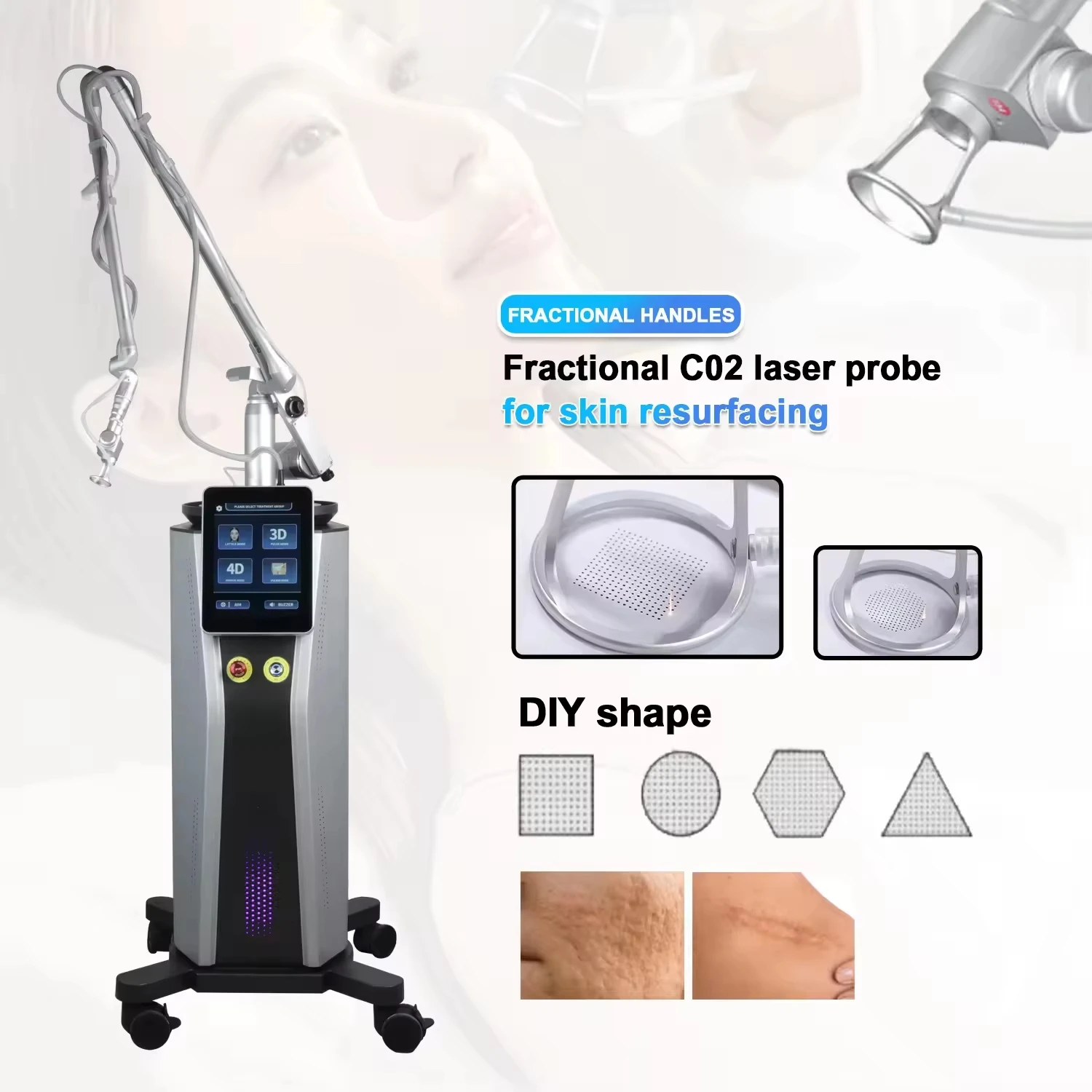Co2 Fractional Skin…