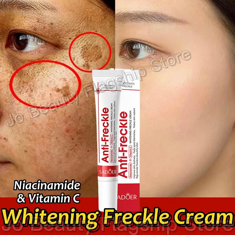 Crema blanqueadora para pecas, elimina las manchas oscuras, cremas faciales antipecas, niacinamida, decoloración, pigmentación, Melasma, ilumina el cuidado de la piel, 20g