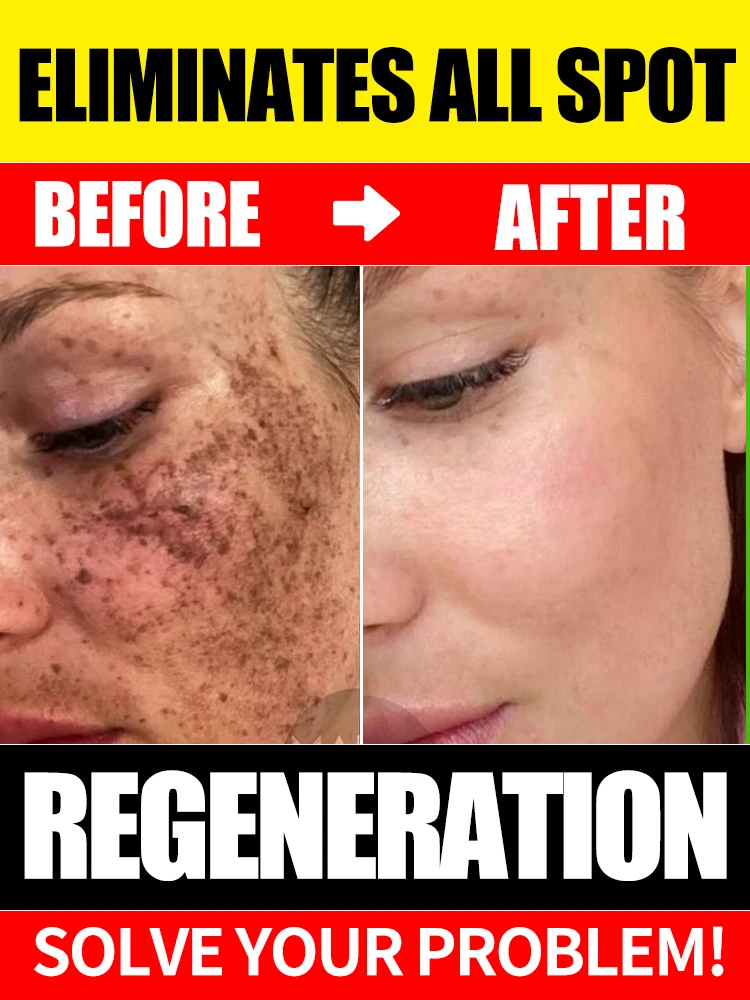 

Повышает сияние и минимизирует внешний вид темных кластеров.