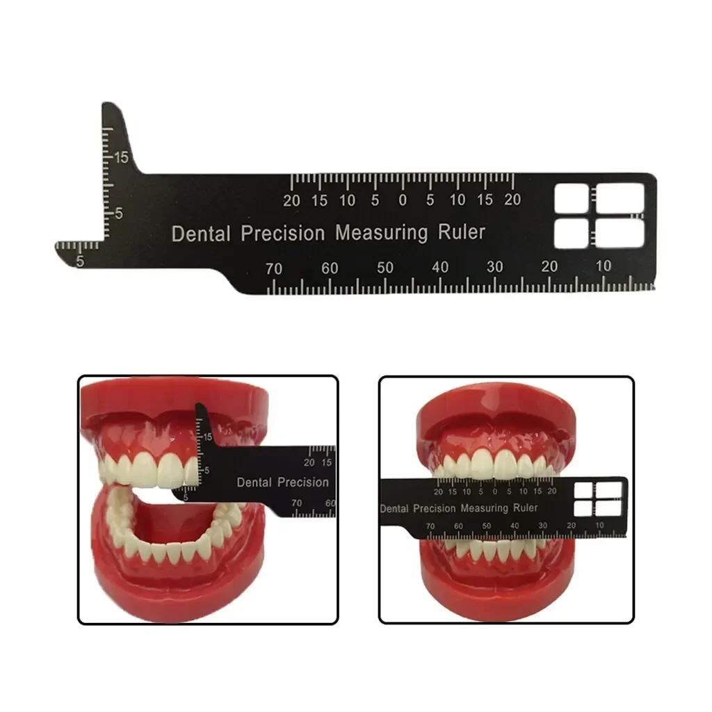 Dental Precision Measuring Ruler Gap Gauge Span Measure Scale Orthodontic Medical Tool Aluminum For Dentisty Photography