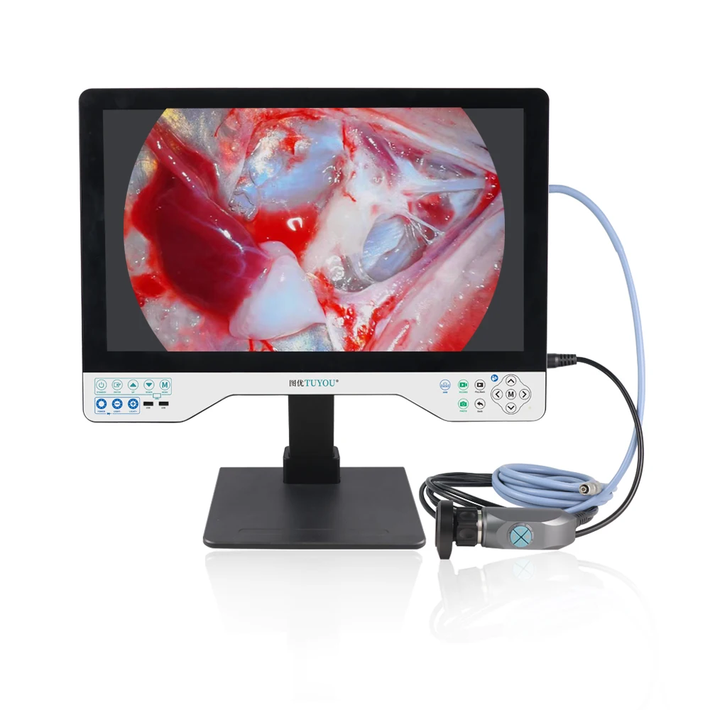 Hot Selling UHD 24 Inch Endoscopy Camera System With Video Recorder for Urologyscope  Laparoscopy  ENT Surgeries