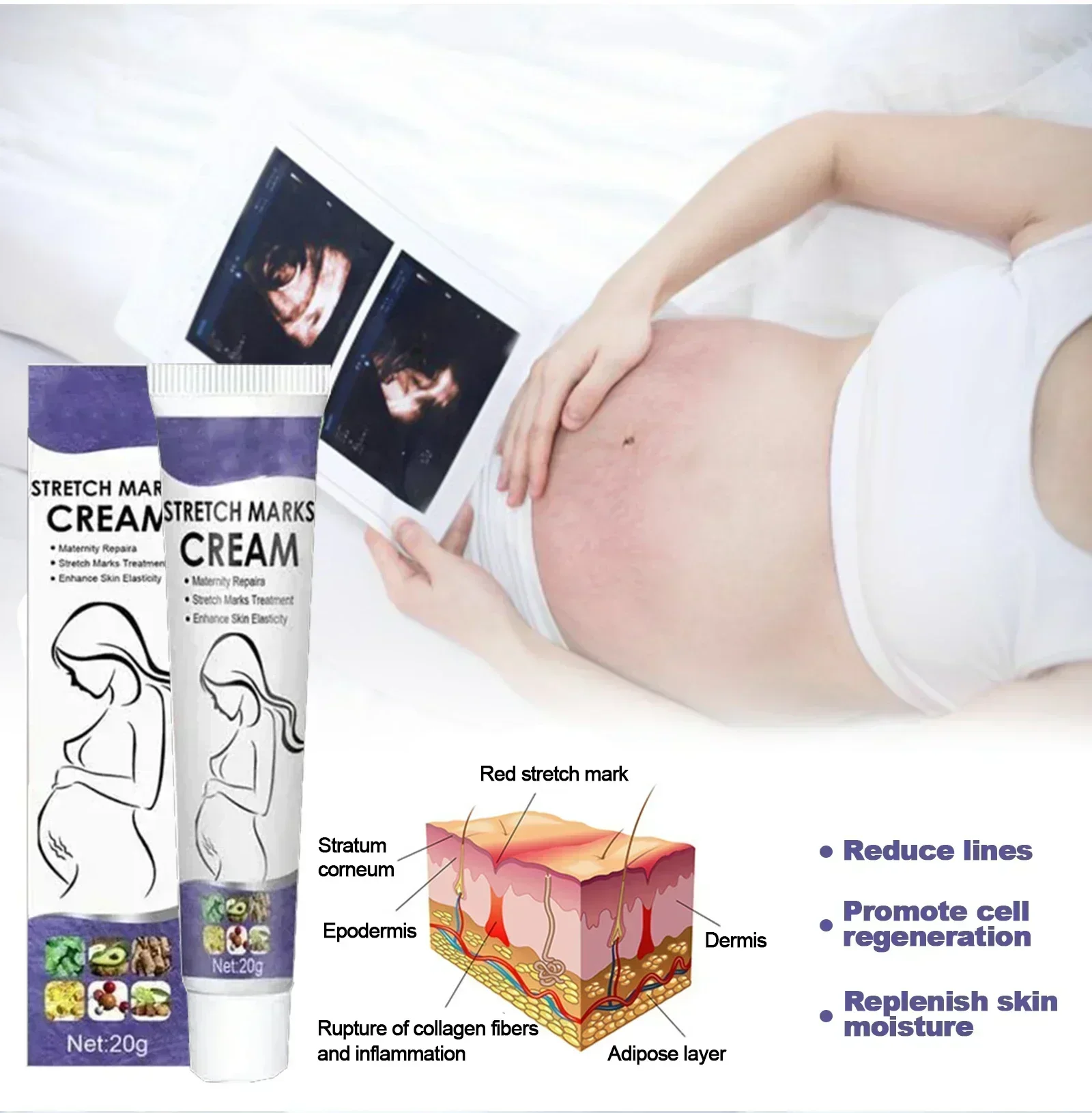 Krim penghilang Stretch Mark, krim perbaikan untuk wanita hamil, tanda obesitas, tanda pertumbuhan, kulit pengencang paha