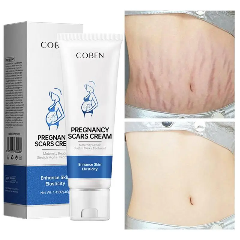 

only 7 day Stretch mark cream Postpartum repair skin tightening repair cream oil for pregnant women