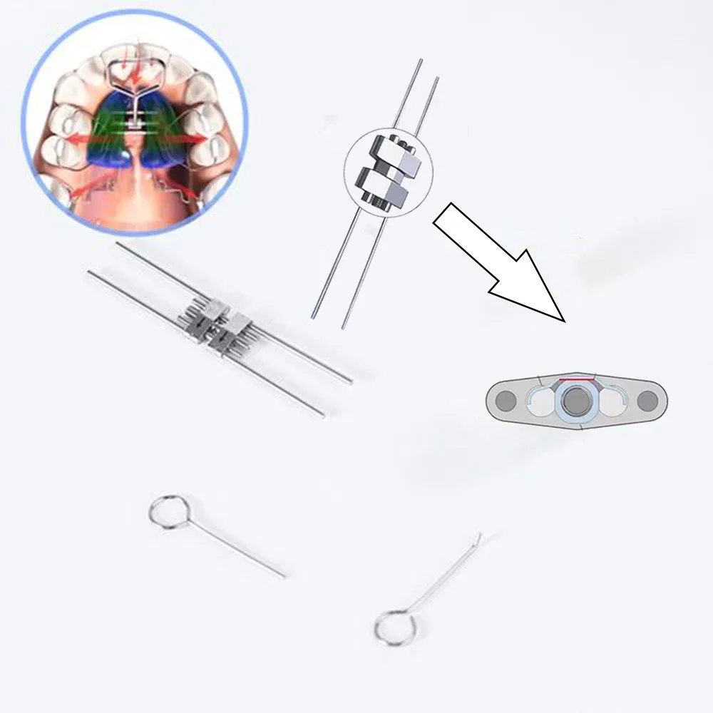 

Dental Palate Expander Orthodontic Screw Expansion Frame Type Stainless Steel Rapid Palette Screws Dentistry Ortho Accessories