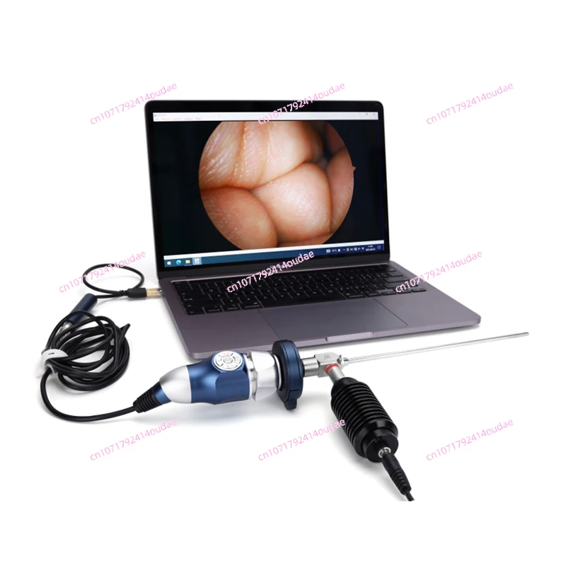 Portable USB Endoscope Camera 1080p