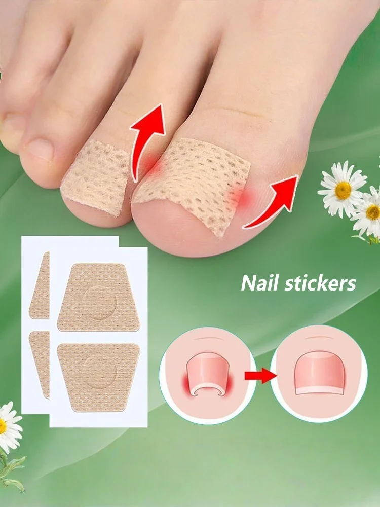 Toenail Fungus Patch Nail Repair Patches Nail Ingrown Correction Stickers for Discolored or Damaged Nails Sticker Toenail Care