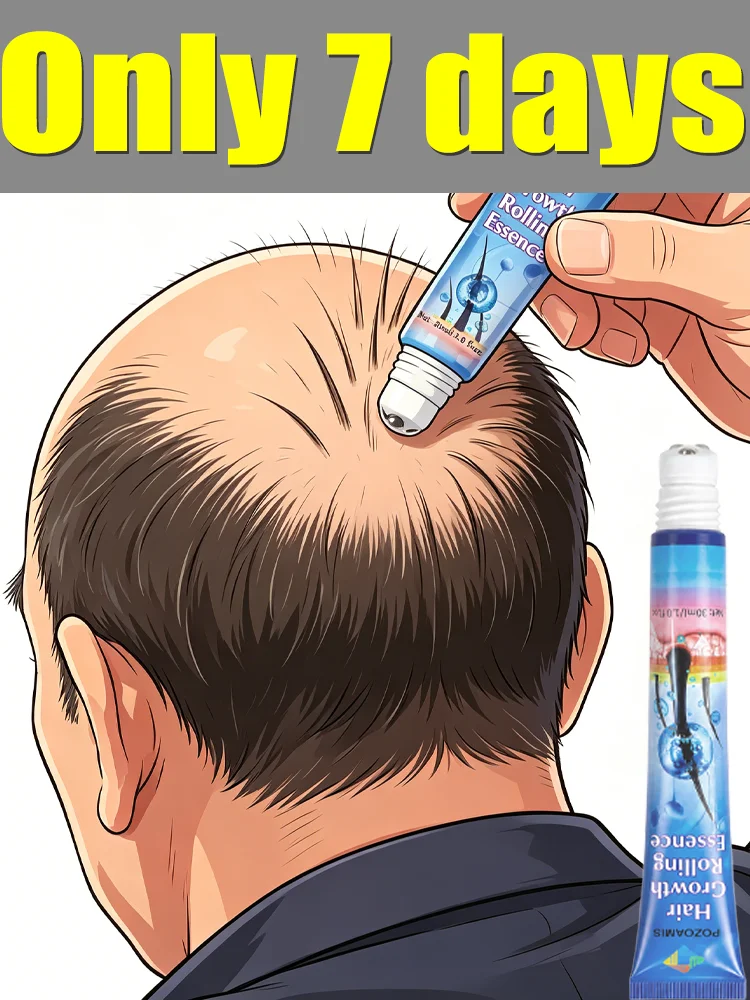 Portable Scalp Roller Essence, Revitalize Scalp Condition for Voluminous Hair.