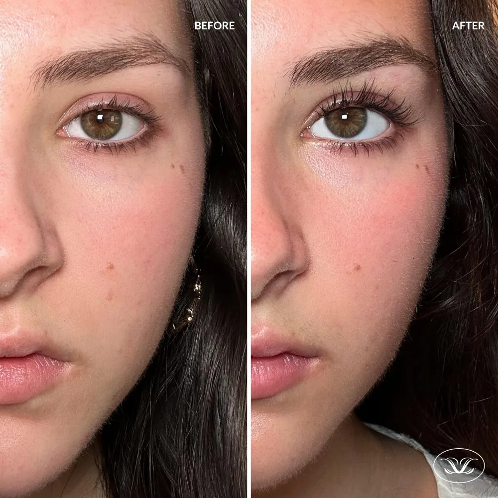 Siero per ciglia purificato LiLash originale per crescere ciglia più lunghe e dall'aspetto più pieno Potenziatore per la crescita delle ciglia 2 ml, fornitura di 90 giorni