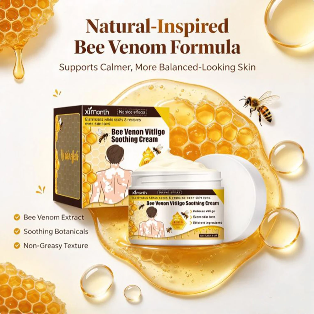 Vitiligo cream, gentle and soothing for vitiligo white patches, easy to absorb