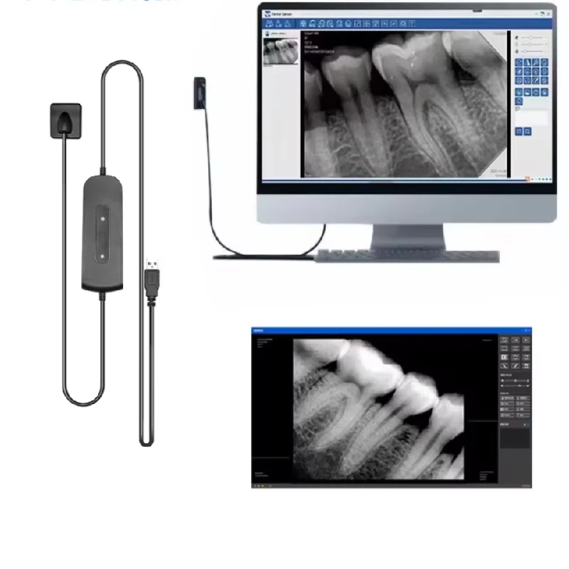 1set Portable Dental Sensor X-Ray High-Frequency Rx Digital Intraoral Digital System Image Dentistry Tools Super Speed Sensor