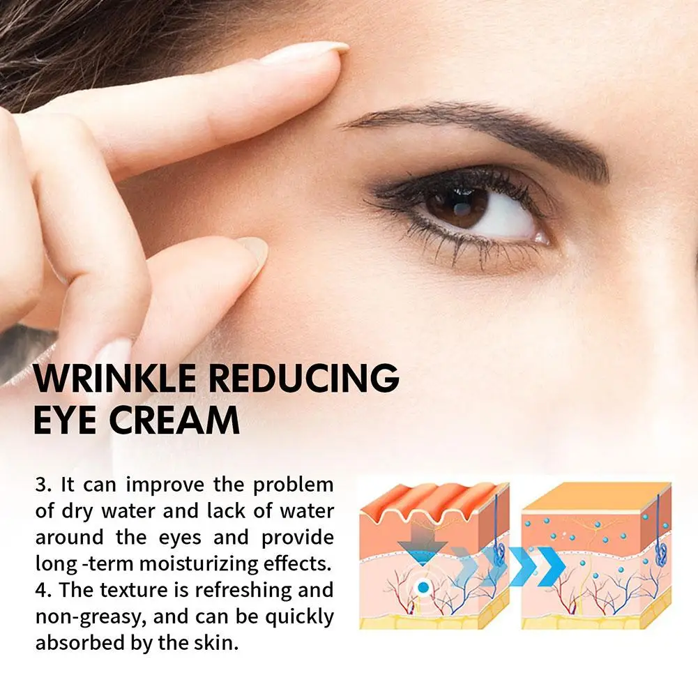 Retinol Eye Cream Dark Circles Remover Eye Bag Repairing Firmness Under Lines Eyes Serum Whitening Fade Puffiness Treatment F3H8