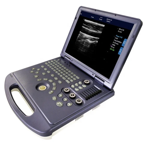 Black And White Digital Portable Vet Ultrasound Scanner Pet Ultrasound Machine