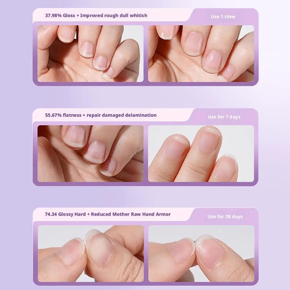 ขายร้อนโภชนาการเล็บ Cuticle Oil Anti-Edge Barb Dead Skin Revitalizer เล็บบํารุงผิว Protector เล็บเครื่องมือ