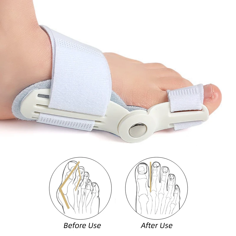 

2PCS Toes Corrector Straightener Halux Valgus Splint Foot Care Separator Bunions Hallux Valgus Spreader Separators Corrector