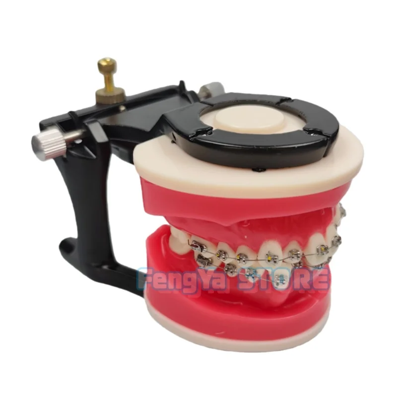 1Pcs Dental Orthodontic Teeth Practice Model Red Wax Gum Tooth Model with Metal Brackets For Dentist Teaching Study Communicatio