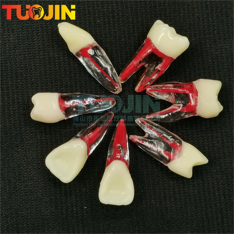 Dental Endodontic Root Canal RCT Practice Endo Teeth Tooth Model Pulp study Colored Root Canal and Pulp Transparent Models