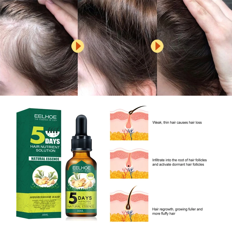 Natural Ginger Hair Growth Products, Anti Hair Loss, Prevenir a calvície, tratamento, crescimento rápido, nutrido, seco, danificado Hair Care, 5 dias