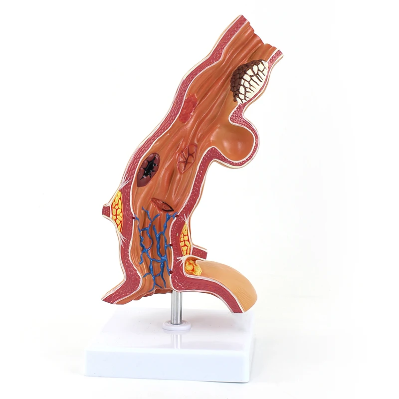 

Human Esophagus Anatomical Model Medical Anatomical Department of Esophagus and Digestive Model for Medical Educational