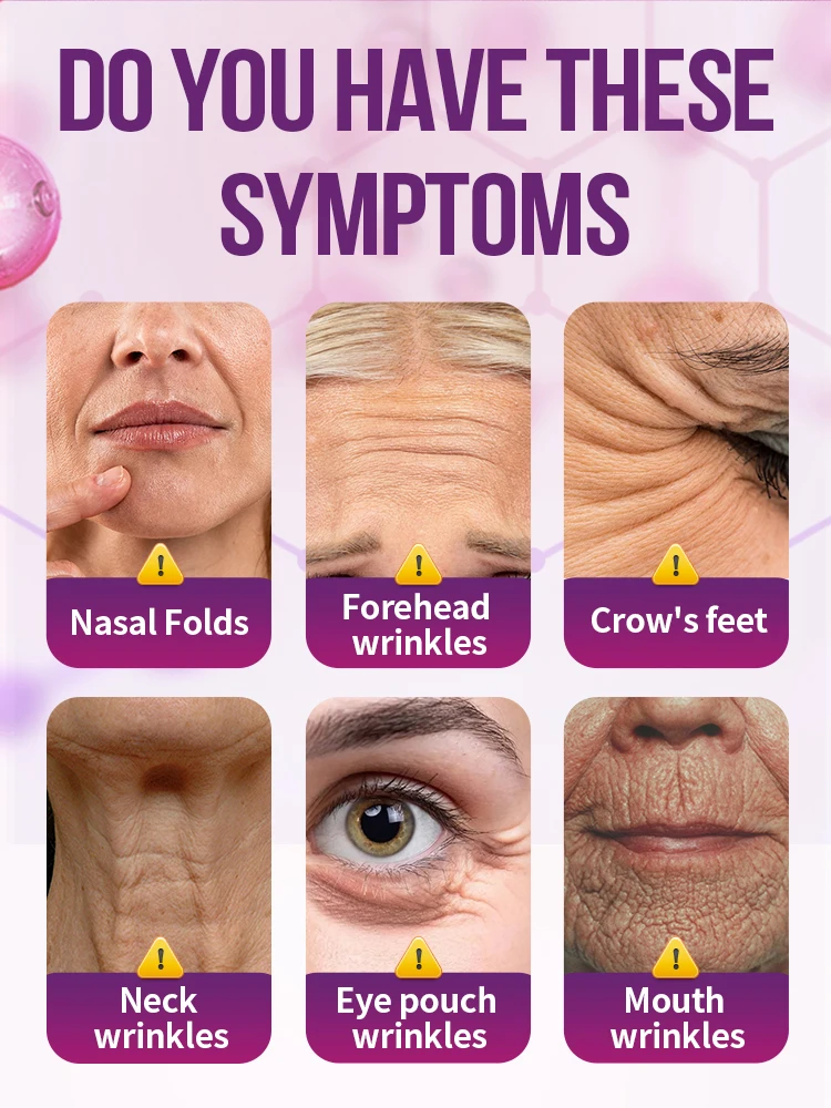 تنعيم علامات الشيخوخة، أدوات العناية بالبشرة، قلم الضوء الأزرق يحل التجاعيد، شحن مجاني