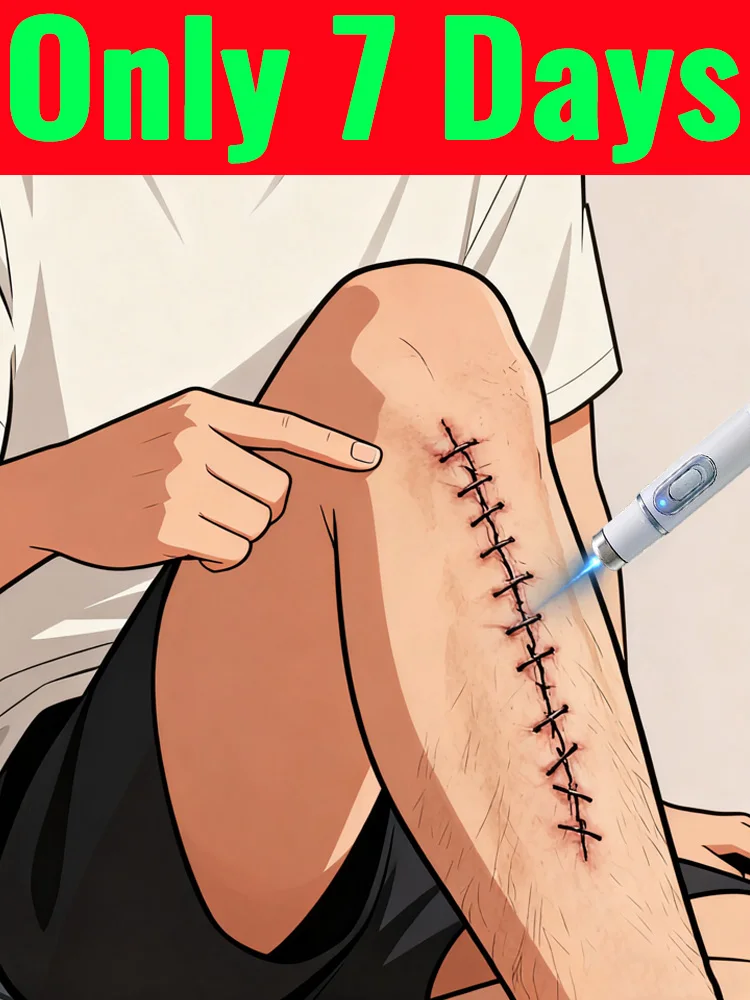 يقوم ترقية الجيل الثالث بحل مشاكلك: جميع الندبات تختفي. #1