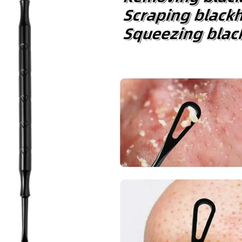 1 قطعة مزيل الرؤوس السوداء بثرة بوبر أداة حب الشباب إبرة إزالة العلاج الأبيض ظهرت Zit الأنف الوجه العيب النازع أداة #1