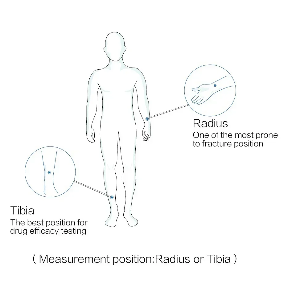 Medical Diagnostic Equipment Digital Portable Dexa Ultrasound Scan Bone Densitometer