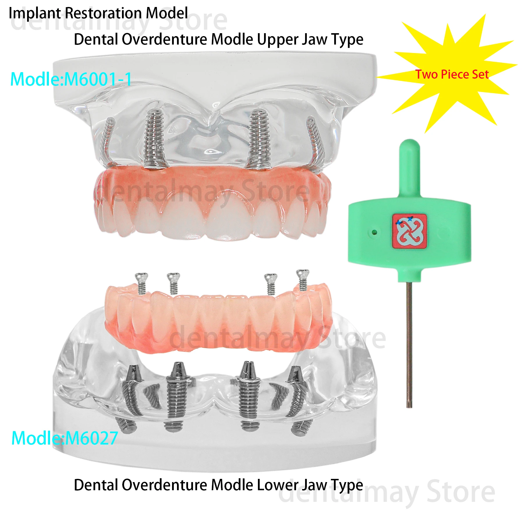 

Dental Implant Teeth Model Kit Transparent Upper/Lower Jaw Type All on 4 Overdenture Modle With 4 Removable Screws