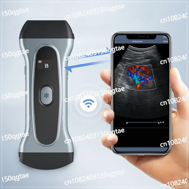 Wifi Wireless Mini Double Probe Cow Pet Vet Handheld Pregnanc Scanner Portable Ultrasound Machine Veterinary for Animals