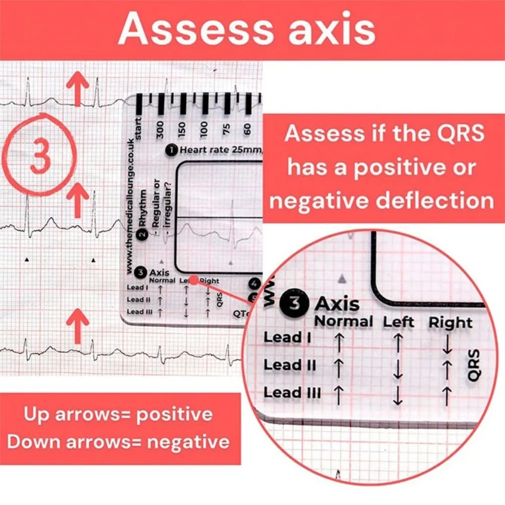 Interpretation ECG 7 Step Ruler Card Clear Portable Pocket Ecg/Ekg Reference Guide with Protective Sheath Measuring