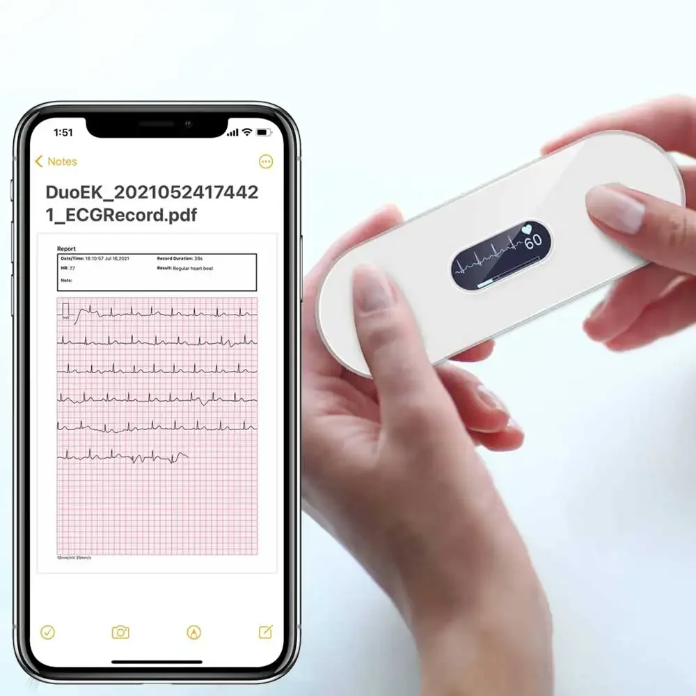 Portable Bluetooth ECG Monitor With OLED EKG Holter Heart Health Monitor Screen Show Real-time EKG Electrocardiograma Charge