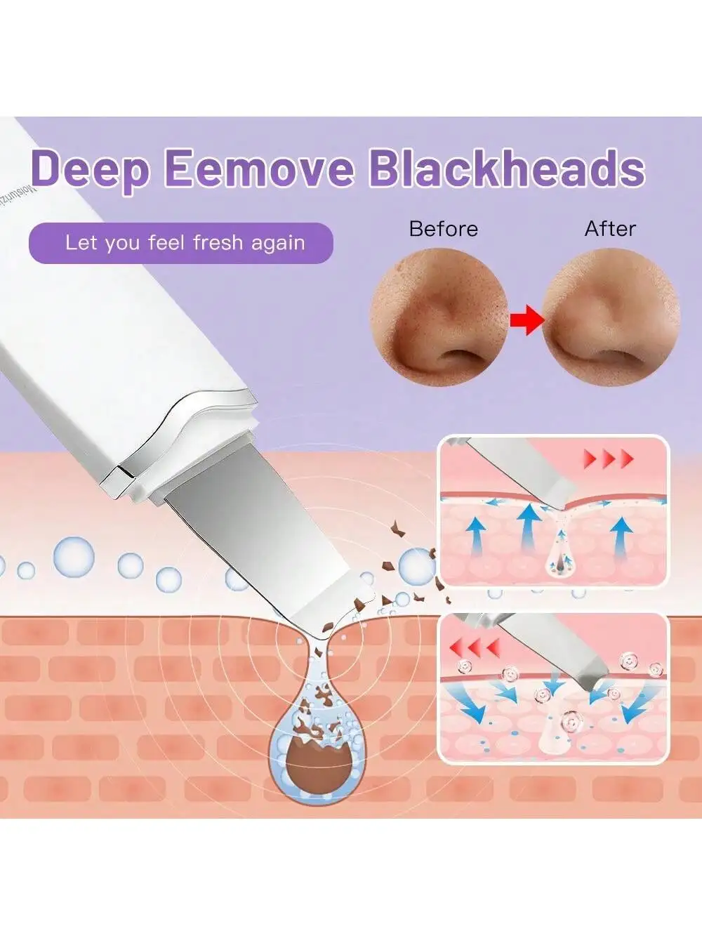 Ultrasone Huid Scrubber Scrubber Diepe Trillen Gezichtsreiniger Schop Gezicht Scrubber Peeling Black Head Remover Gezichtsmassager