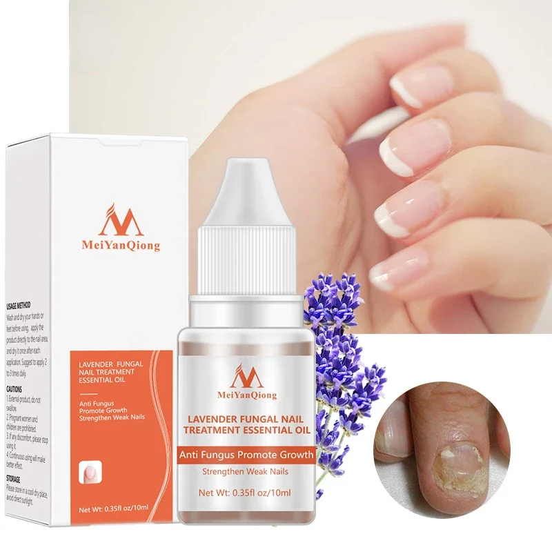 1 Fles 10Ml Gedroogde Bloemen Verzachter Nutritionele Nagelriemolie Behandeling Voedzame Gel Polish Cuticula Nail Art Tool Nagelverzorging Olie