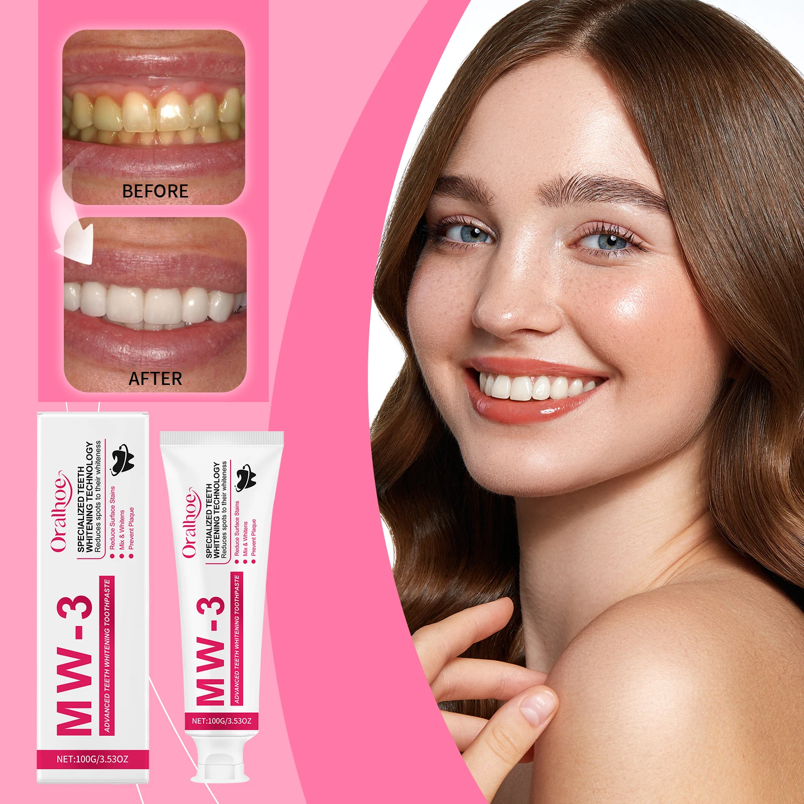 

Зубная паста ORALHOE Advanced для отбеливания зубов с мятным вкусом, интенсивное удаление пятен, очищение зубов, свежесть полости рта