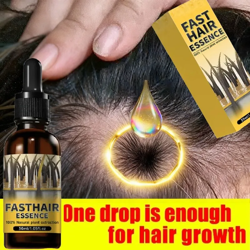 

Лечение роста волос от восстановления выпадения волос: питает кожу головы, повышает кровообращение и укрепление прядей – легкий, нежирный