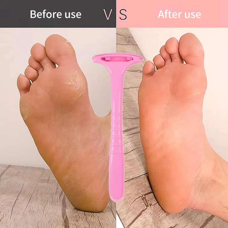 1/5pc ﻿Foot Heel Callus Scraper Handle Dead Skin Shaving Remover Foot Care Pedicure Tools Professional Plastic Portable Pedicure