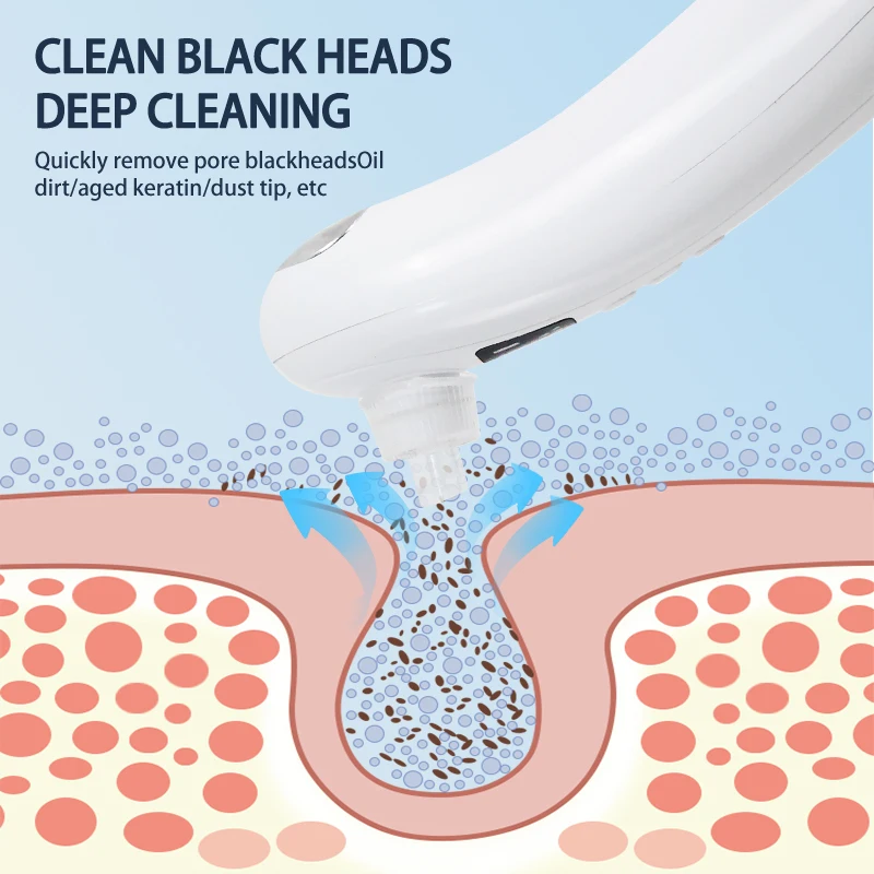 Aspirazione elettrica dei punti neri Brufolo elettrico Rimozione della testa nera Rimozione della testa USB Ricaricabile Aspirapolvere dei pori dell'acqua Pulizia dei pori del viso