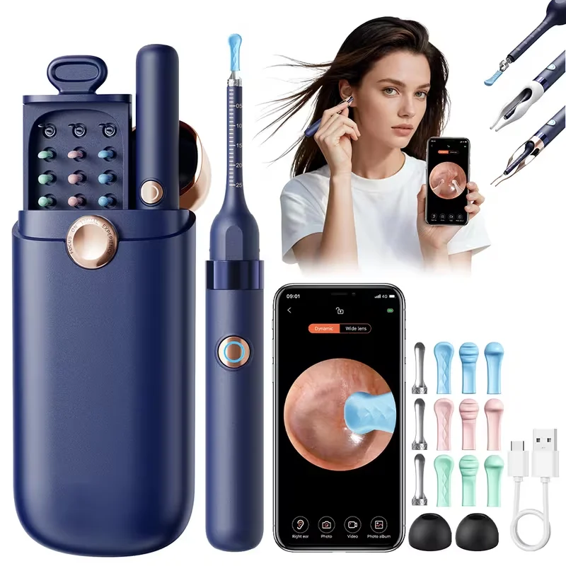 

Ear Wax Removal Tool Camera with 1000W Pixels Visible Ear Cleaner Kit with Tweezers Ear Cleaning with Light Earpick for Adults