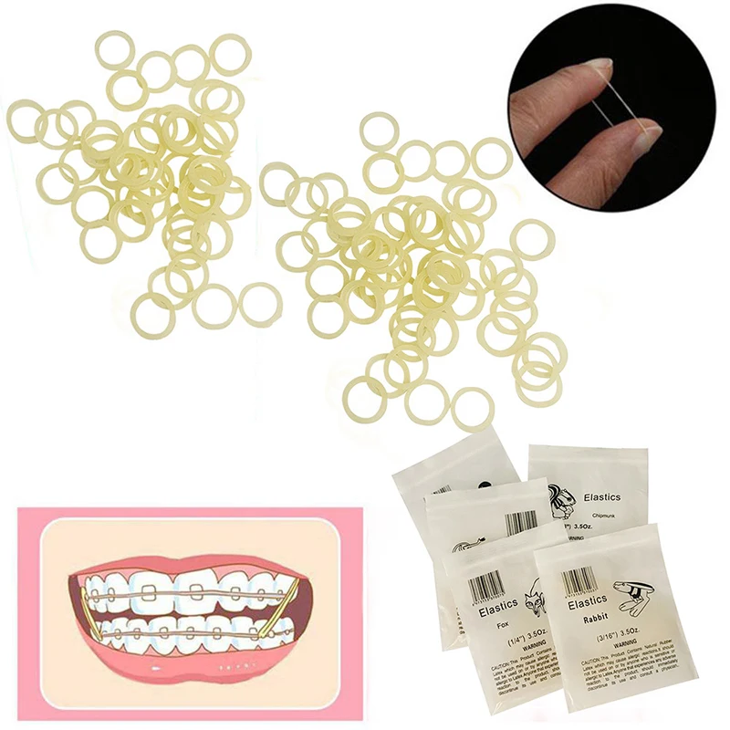 100pcs dental yellow elastomer latex rings, braces, dental rubber bands, non-toxic material 3.5OZ dental rubber bands