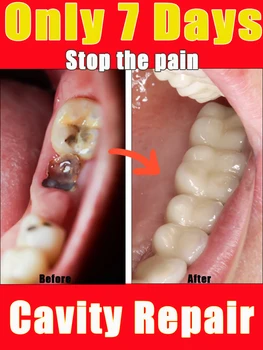 Ensinar a cárie dentária reduzir a dor restaurar os dentes normais