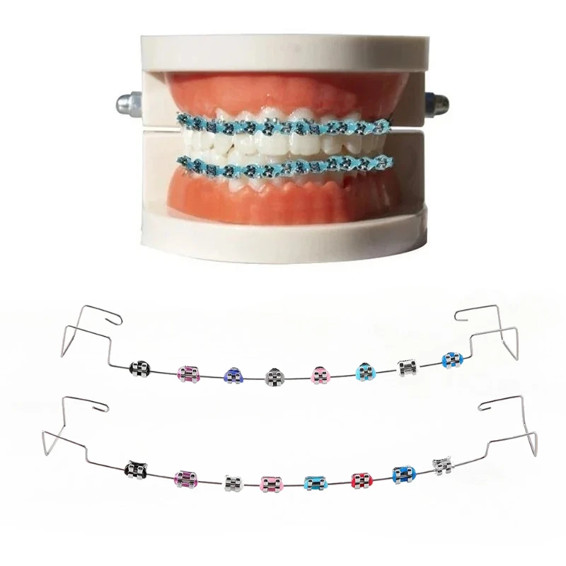 Fashion 1 Pair Dental Braces Colorful Temporary Teeth Decoration Metal Bracket Arch Wires Orthodontic Ligature Ties High Quality