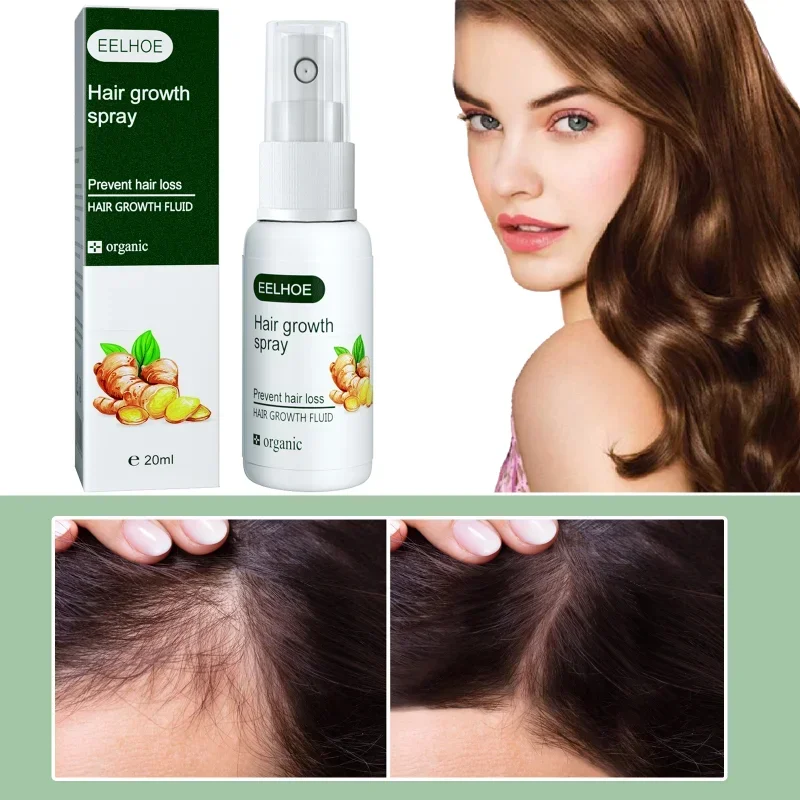 Ginger Serum Hair Growth Spray  Anti Hair Loss Products Fast Growing Prevent Baldness Treatment Germinal Liquid Men Women