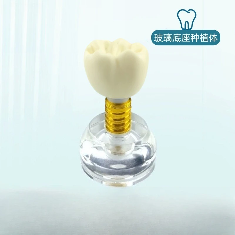 Crystal dental implant model, transparent dental model, teaching doctor-patient communication model, clinic ornament dentistry