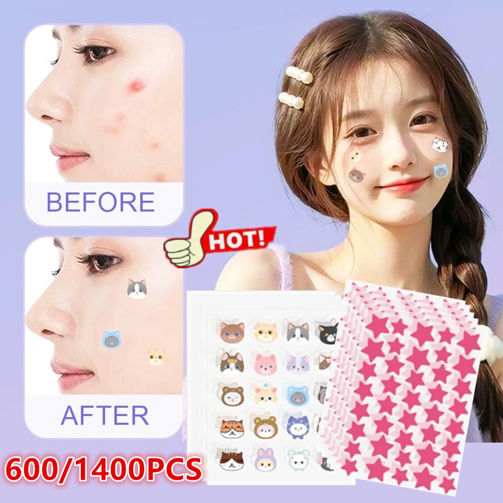 Colorful Star Pimpl… - image