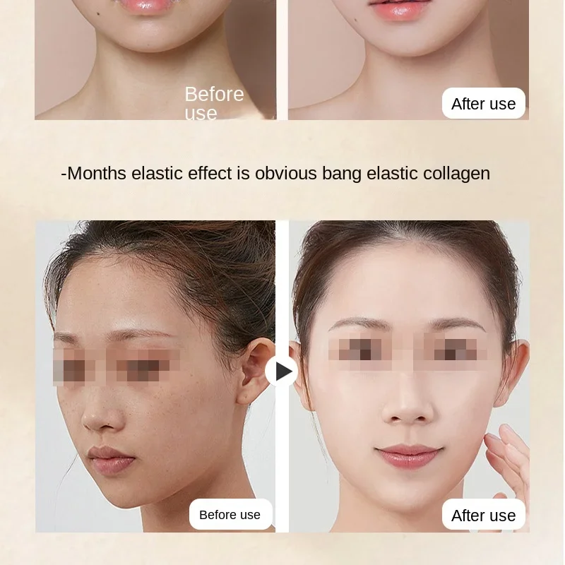Free Shipping Hand-Held Ultrasonic Beauty Face Lifting and Tightening Removing French Lines Wrinkle Removing Home