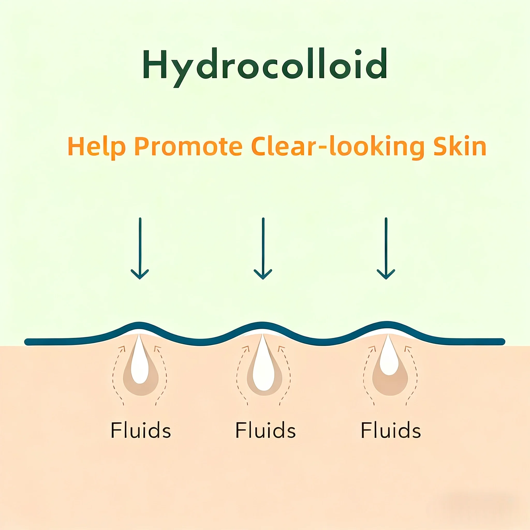 27/54/81-teilige HITWORKER Aknepflaster – angereichert mit Salicylsäure, Teebaumöl und Kalendulaöl |   Für Akne und Hautunreinheiten, Rückstände