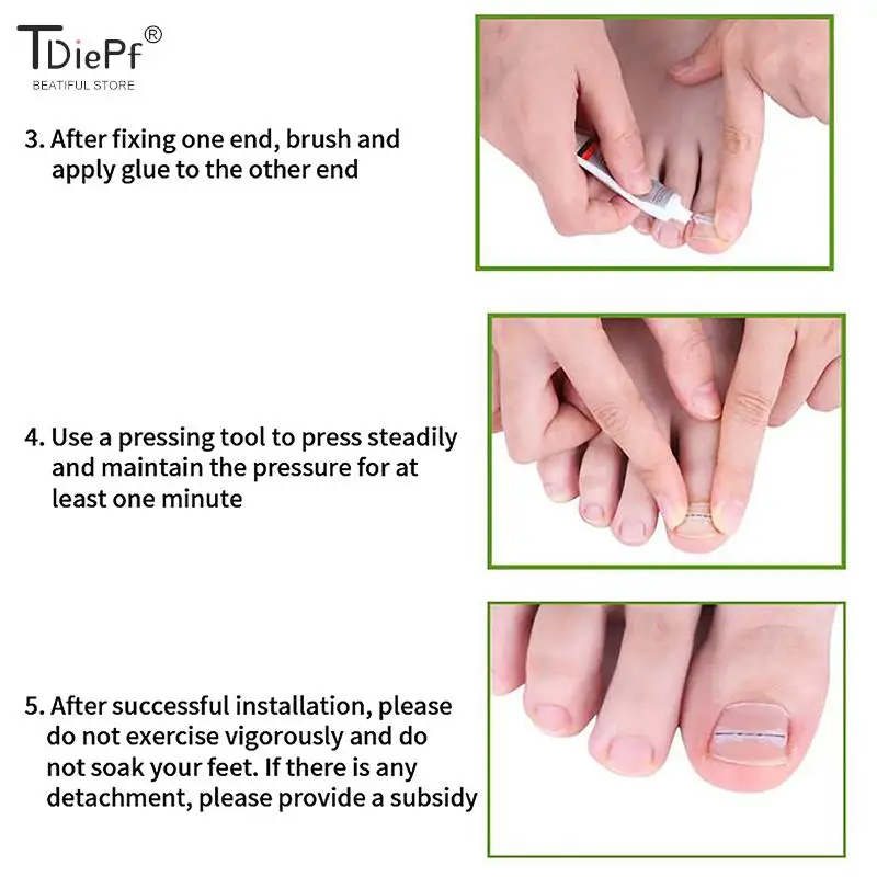 Ingrown Toenail Corrector Tools Pedicure Recover Embed Toe Nail Treatment Professional Ingrown Toenail Correction Foot Care Tool