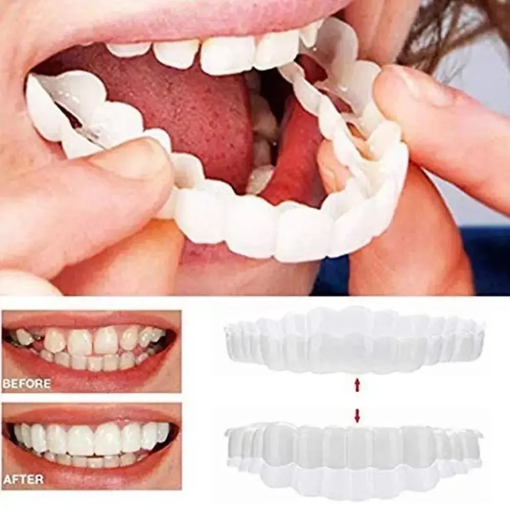 Sdotter New Denture Teeth Instant Smiling Veneer Whitening Tooth Denture Braces Temporary Upper Lower Teeth False Fake Tooth Cos