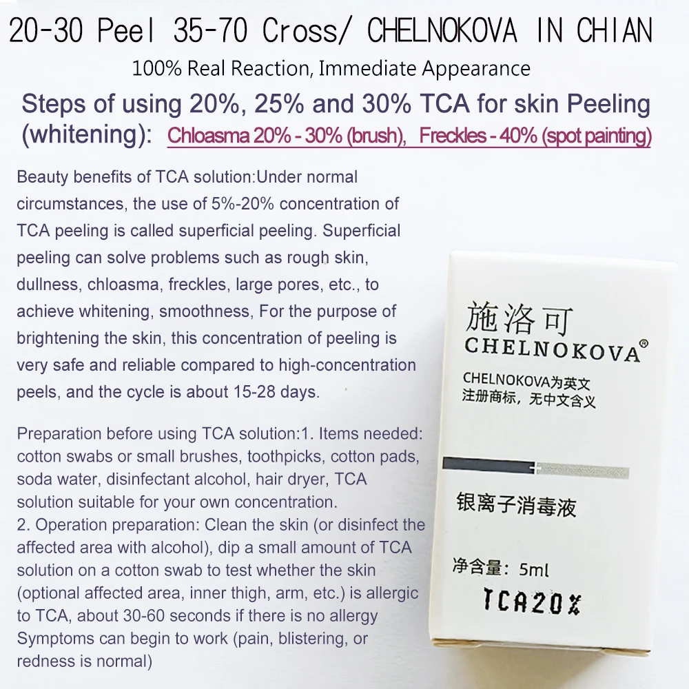 Crema refrescante con solución de neutralización para el cuidado posterior, resultados de la piel de la mano, quelnokova, TCA 20, 30, 35