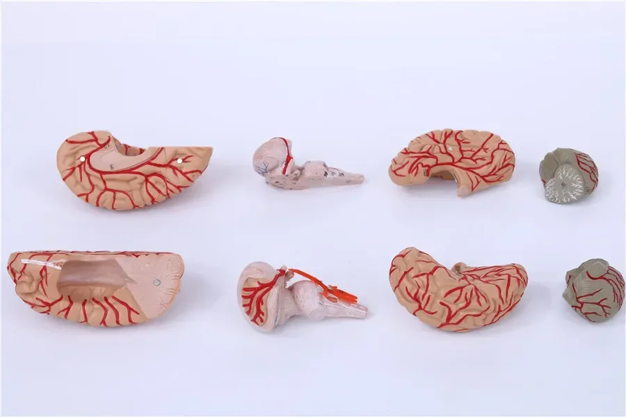 A Medical Neurology: Human Brain Anatomy Model, Cerebral Arterial Model, Detachable With Digital Brain Amplification Model