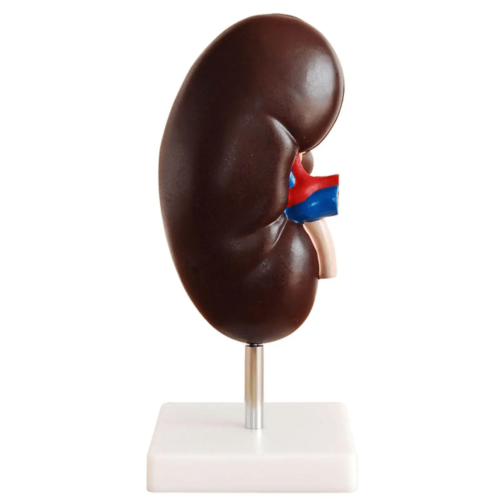 

2 Times Enlarged Human Kidney With Adrenal Glands Anatomical Medical Model